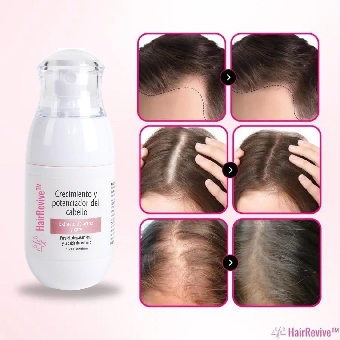 HairRevive™ - (1 + 1 GRATIS)