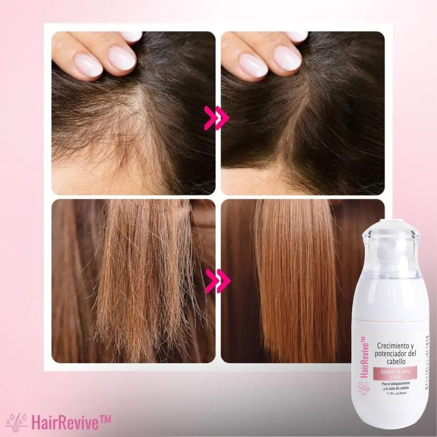 HairRevive™ - (1 + 1 GRATIS)