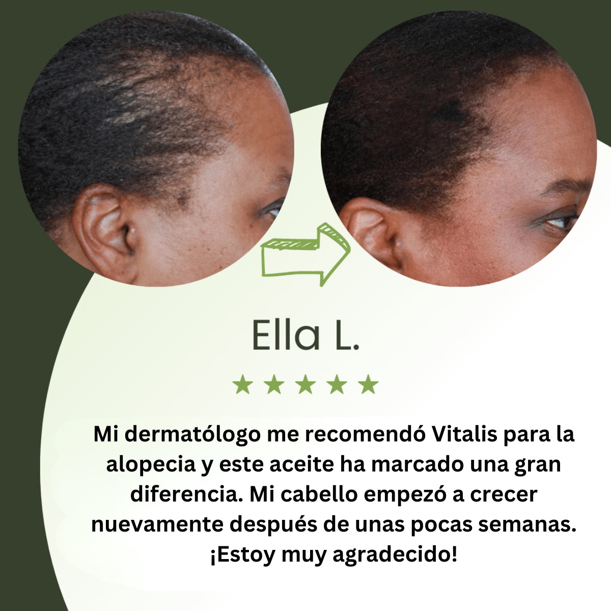 Aceite para el crecimiento del cabello (100% natural) - 1 + 1 GRATIS